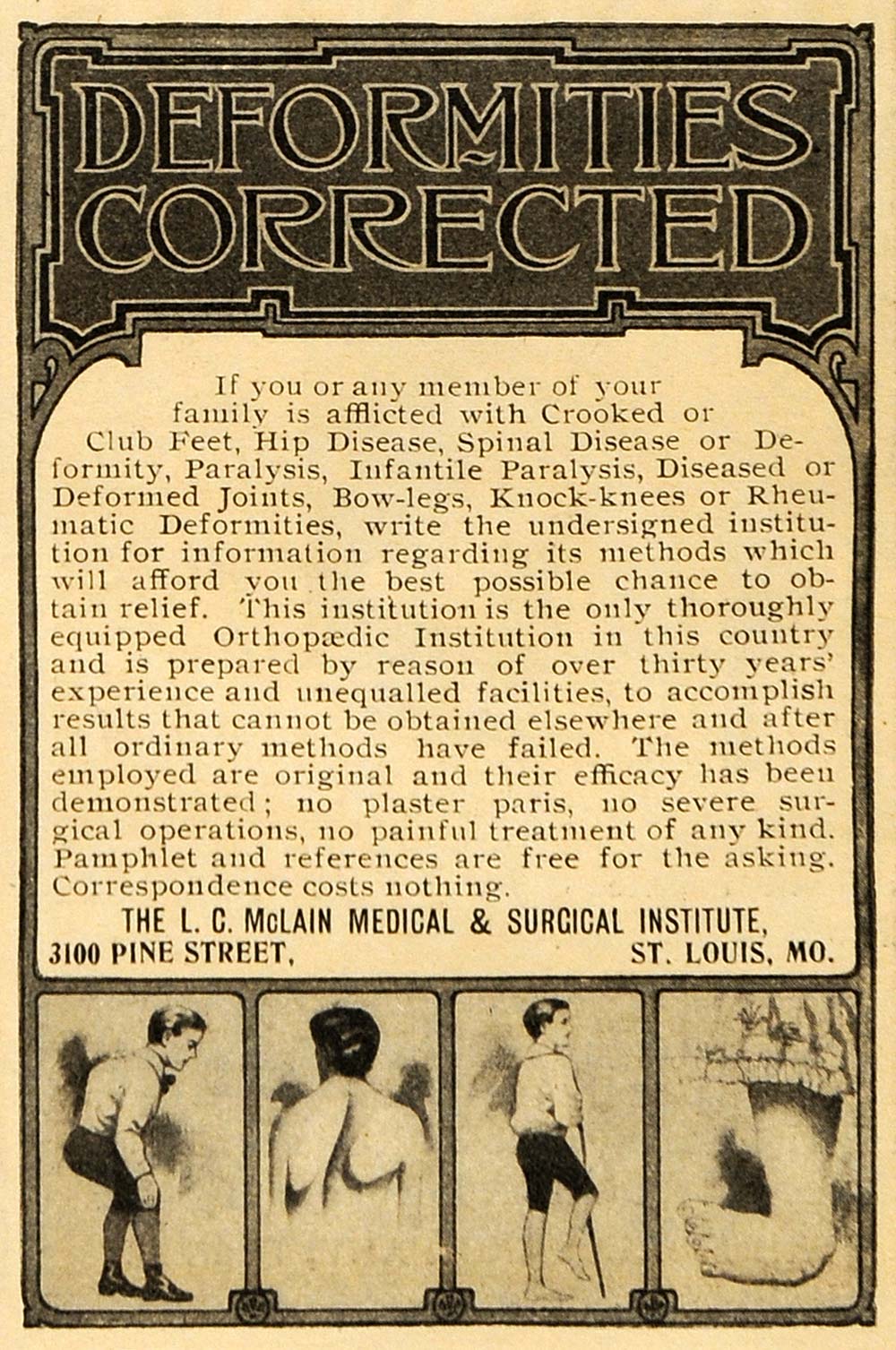 1902 Ad L C McLain Orthopedic Sanitarium Club Feet MO - ORIGINAL ARG1
