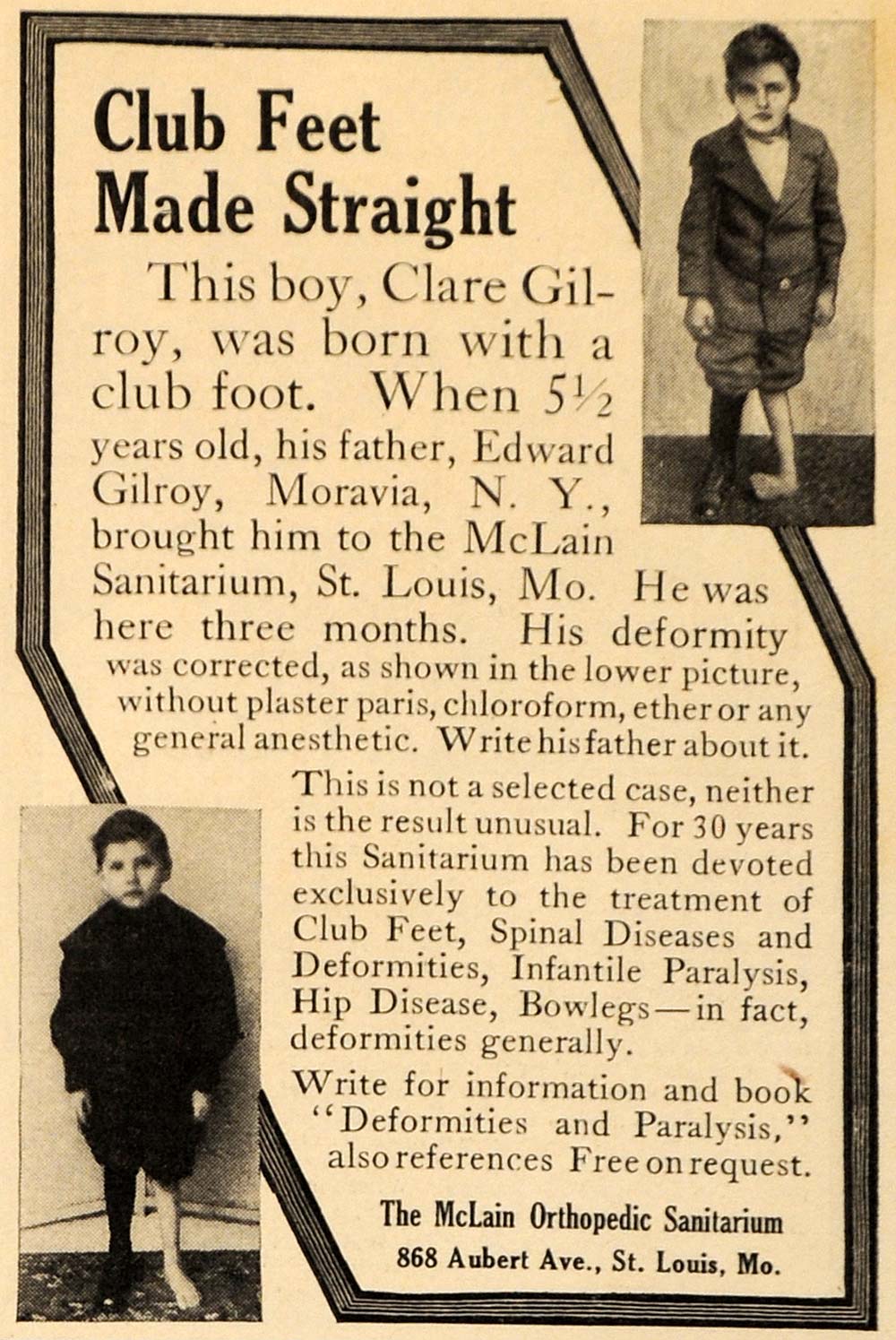 1915 Ad McLain Orthopedic Aubert Sanitarium Club Feet Cure Saint Louis EM1