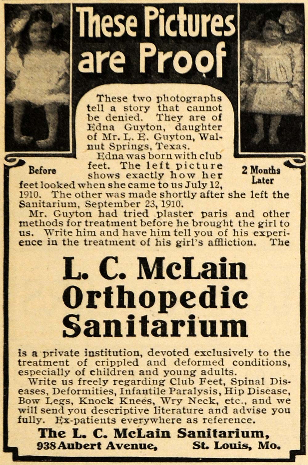 1911 Ad L. C. McLain Sanitarium Club Foot Girl Edna - ORIGINAL ADVERTISING HM1