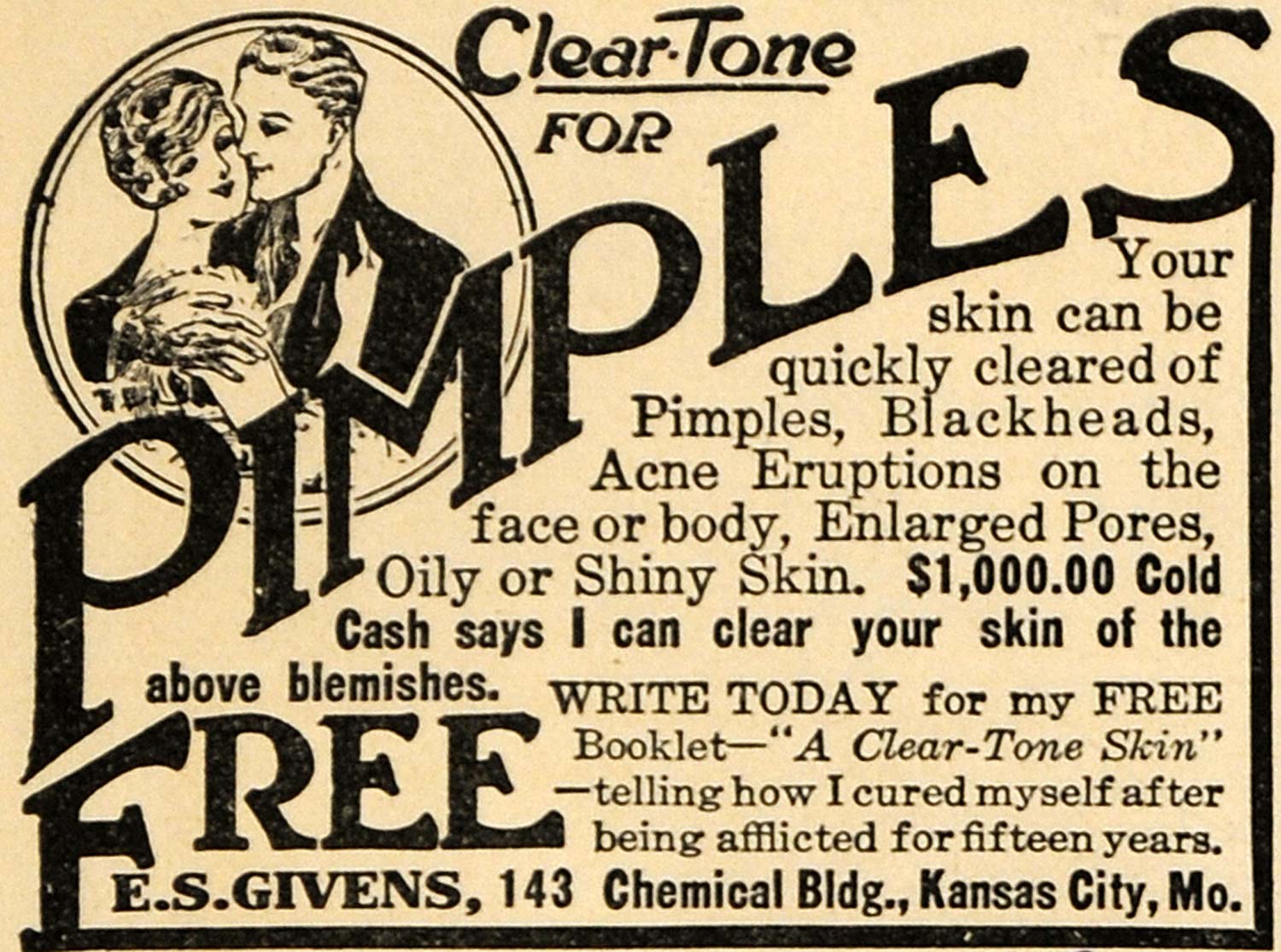 1923 Ad E. S. Givens Pimple Clear Complexion Formula - ORIGINAL ADVERTISING ILW1