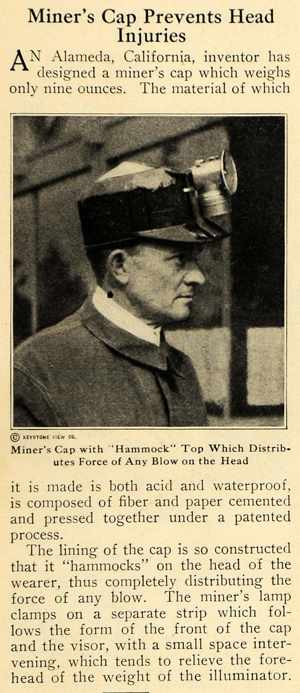 1921 Print Miner's Cap Head Injury Alameda California - ORIGINAL HISTORIC ILW2