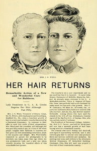 1899 Ad Female Baldness Cure J. S. Weed Swartz Corps - ORIGINAL ADVERTISING LOS1