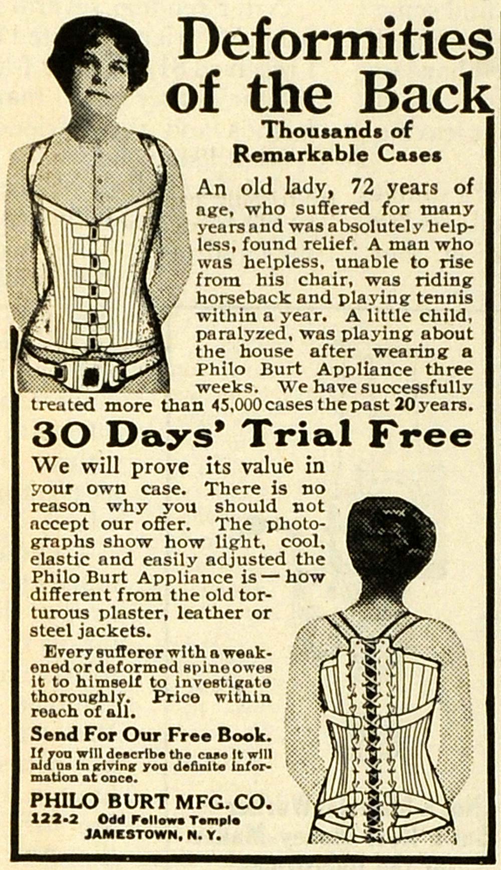 1923 Ad Philo Burt Manufacturing Appliance Device Back Deformities MPR1