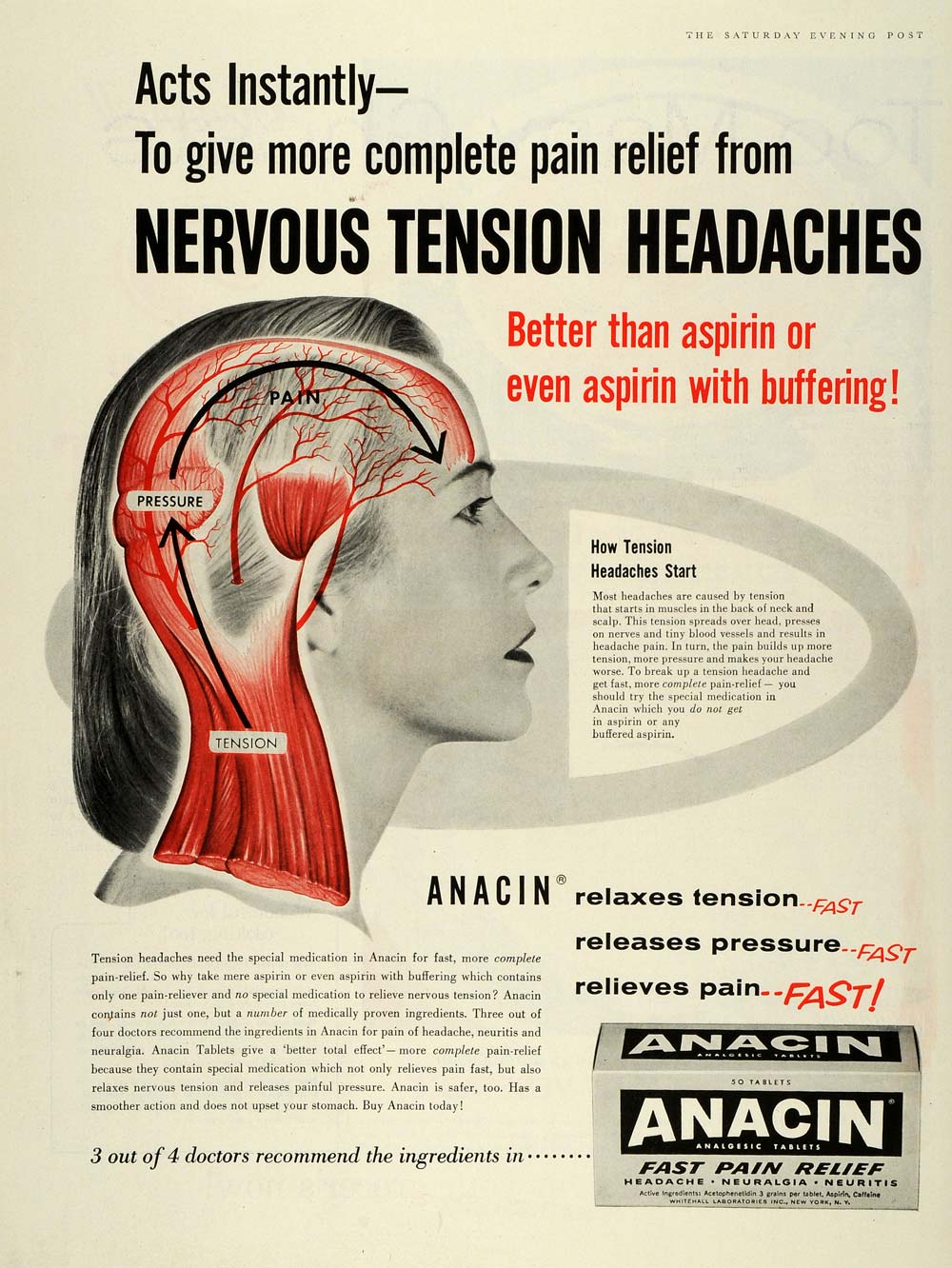 1959 Ad Anacin Pain Relief Nervous Tension Headaches Analgesic Tablets SEP5