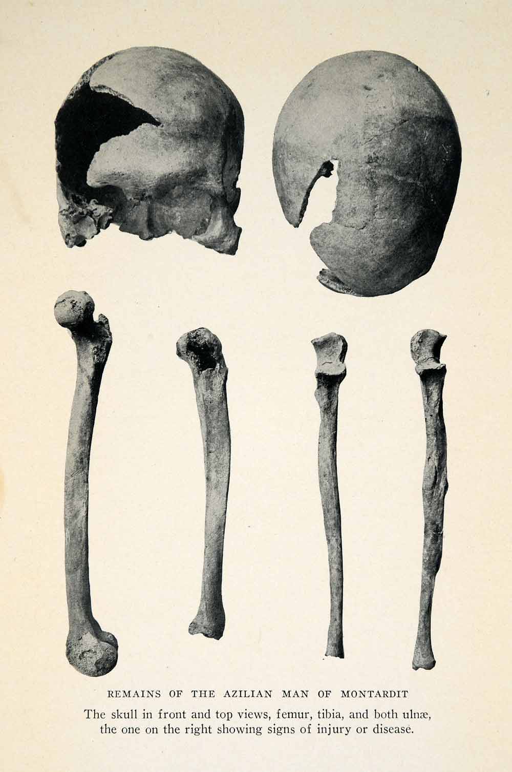 1927 Print Skeleton Skull Femur Tibia Ulnae Remains Azilian Man Montardit XGX3