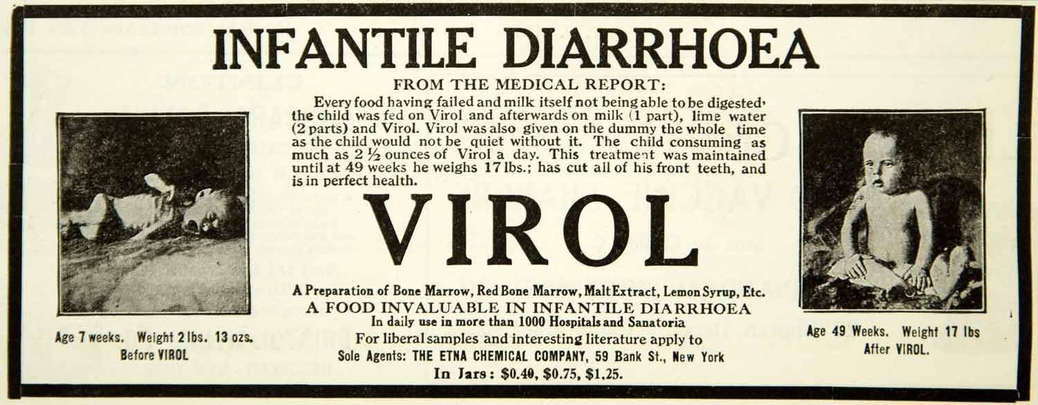 1914 Ad Virol Etna Chemical 59 Bank St NY Baby Diarrhea Medicine Health YBM2