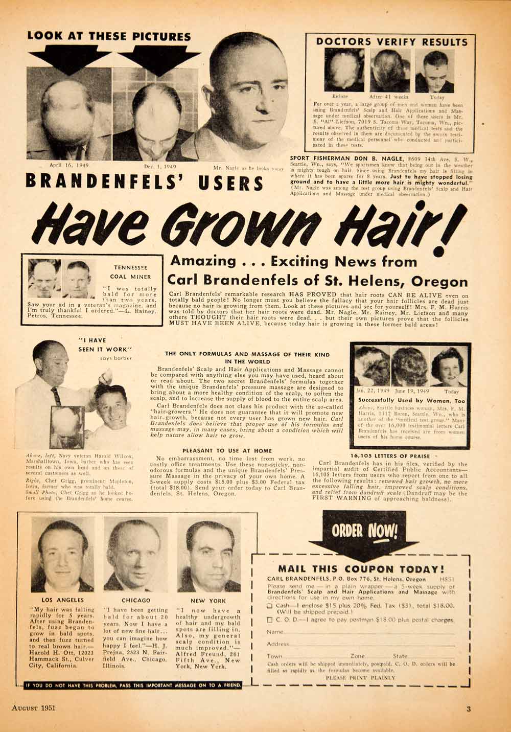 1951 Ad Brandenfels Baldness Scalp Hair Care Health Beauty Toiletry YHF1