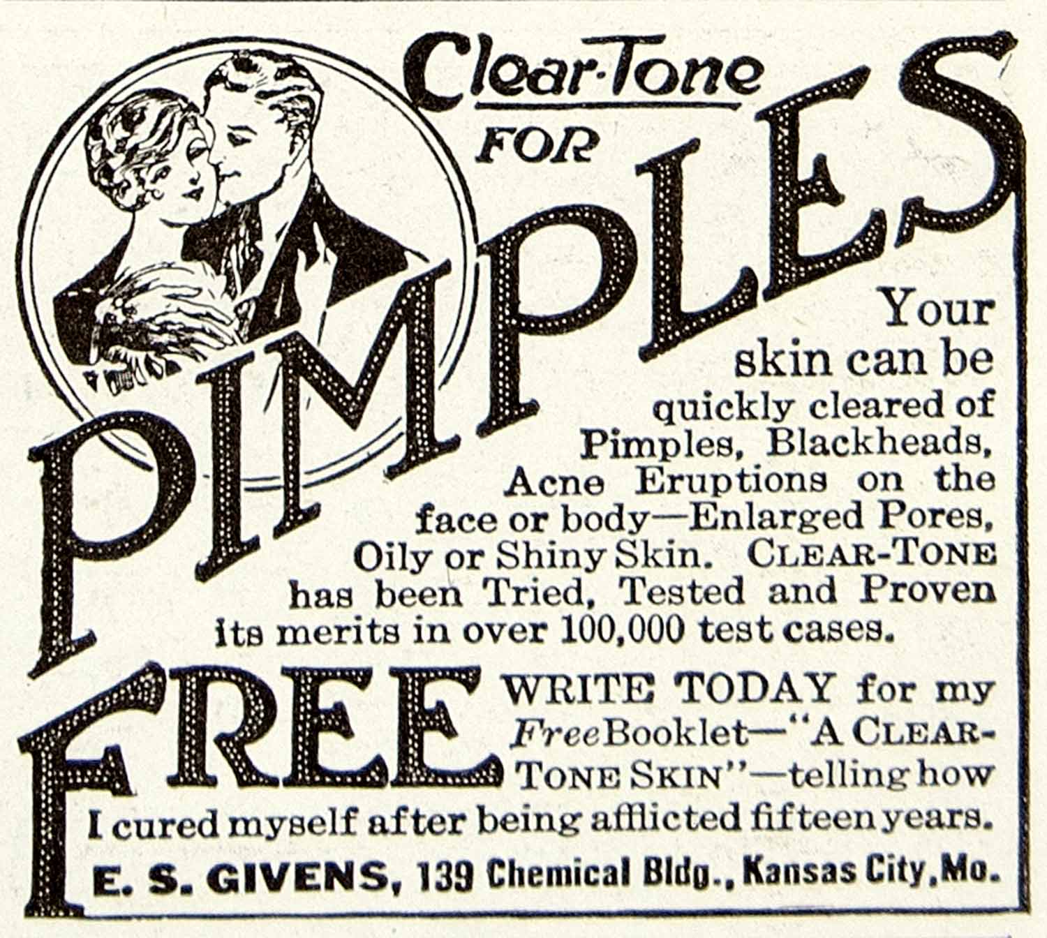 1922 Ad Clear-Tone Pimple Treatment Blackheads Zits Acne Oily Skin E. S YPP2