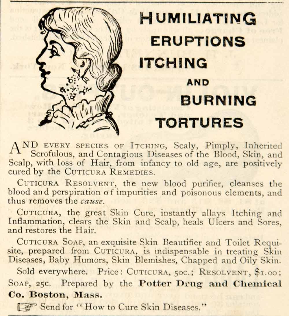 1886 Ad Cuticura Soap Skin Disease Remedy Potter Drug Medical Quackery Cure YSN1